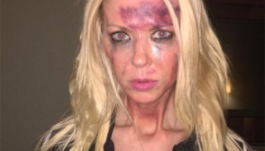 Tara Reid Bruised Face