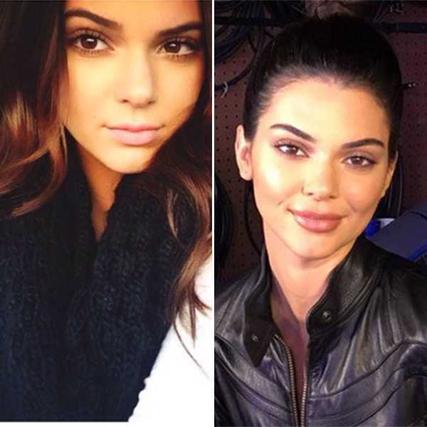 Kendall Jenner S Lips Makeup Or Lip Injections Experts Weigh In Hollywood Life