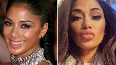 Nicole Scherzinger Lip Injections