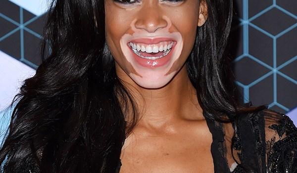 Winnie Harlow EMAs Hair