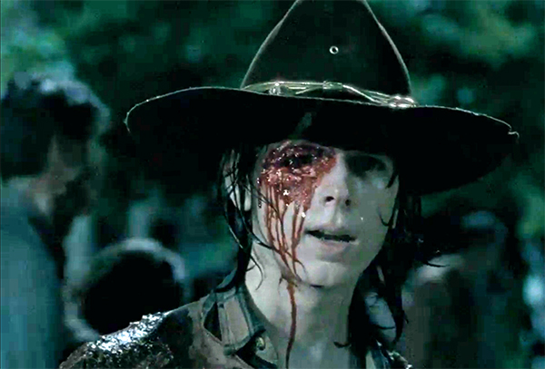 Pic Carl S Eye Socket On The Walking Dead See What S Under His Eye Patch Hollywood Life