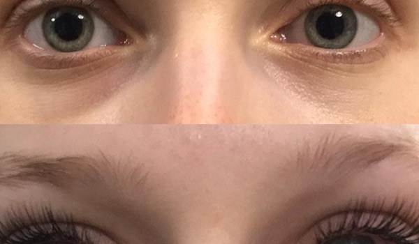 Do Eyelash Extensions Damage Lashes