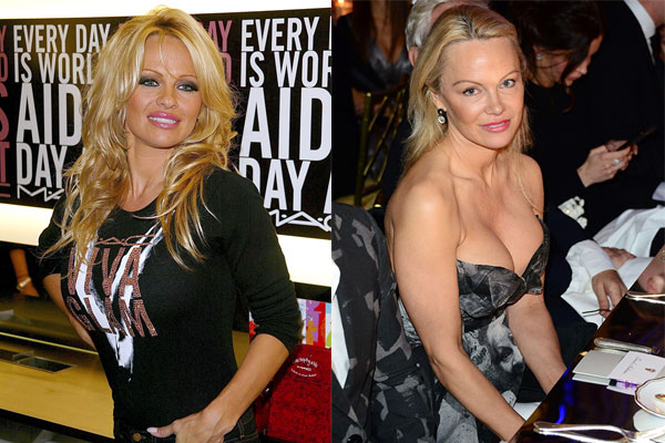 Pamela Anderson Chirurgie plastique