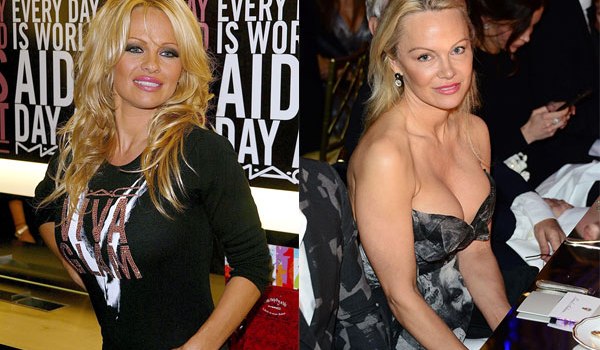 Pamela Anderson Plastic Surgery