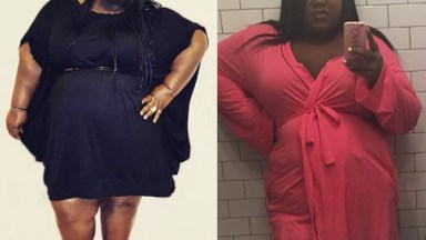 Gabourey Sidibe Surgery