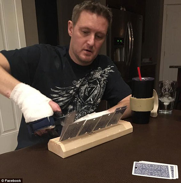 Pics Strep Throat Dad — See Michigan Man Who Lost Hands And Feet To 