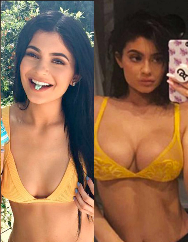 Did Kylie Jenner Get Breast Implants To Go Up Sizes Doctor Speaks Hollywood Life