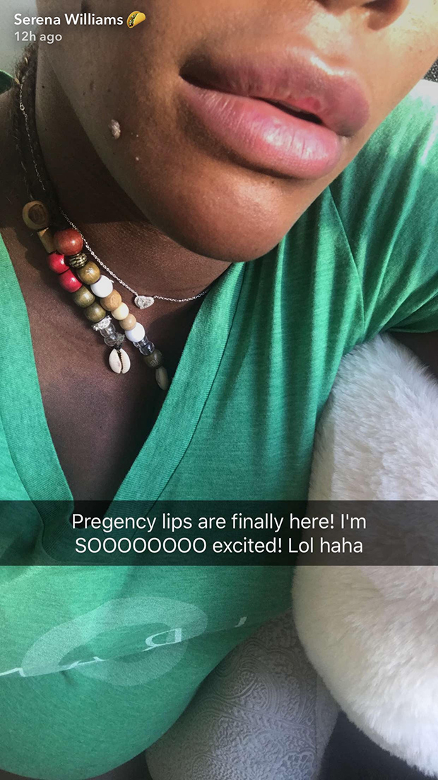Serena Williams Shows Off Pregnancy Lips In New Snapchats 