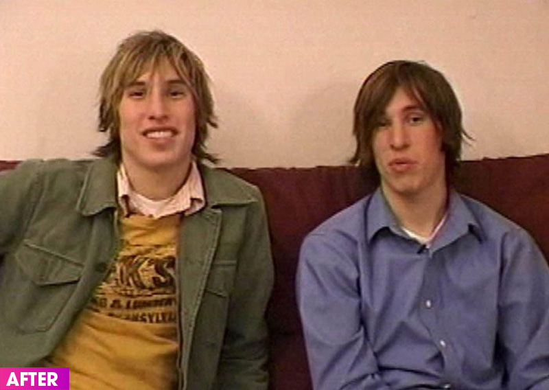 Arizona Twins Plastic Surgery Brad Pitt