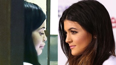 Kylie Jenner's lips before & after baby