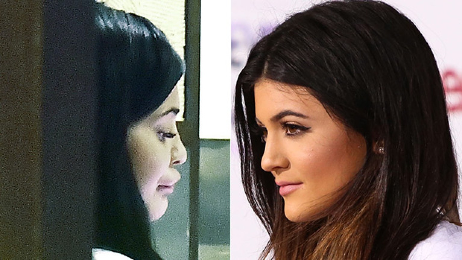 Kylie Jenners Lips Photos Of Her Extremely Huge Pout After Pregnancy Hollywood Life 