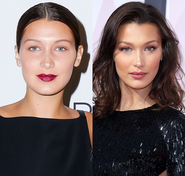 Did Bella Hadid Get Plastic Surgery She Denies Nose Job And Fillers 