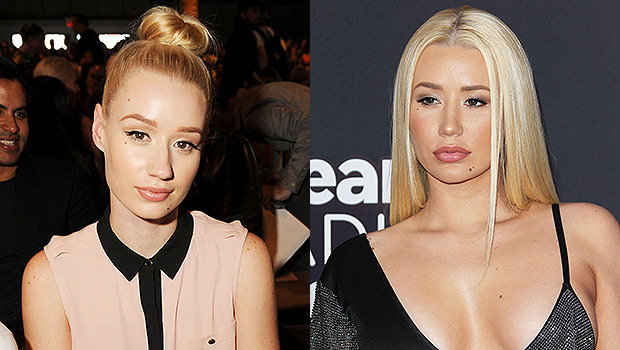 Iggy Azalea