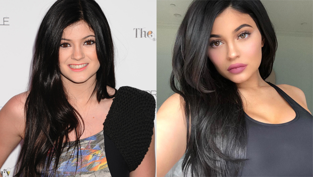 Kylie Jenner’s Face Through The Years — Lips & Makeup Changes ...