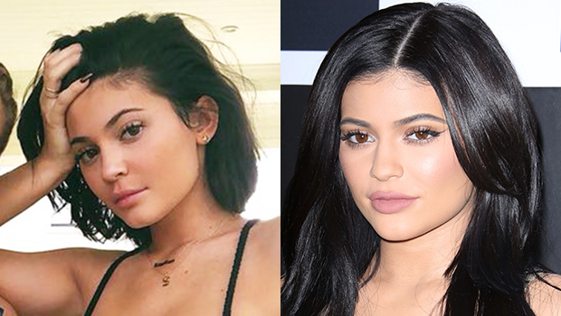 Kylie Jenners Lip Fillers Removed She Reveals New Look – Hollywood Life