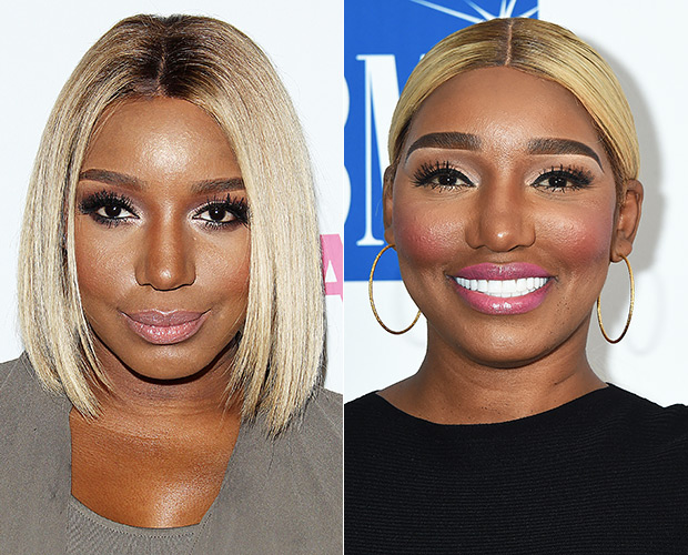 NeNe Leakes Before/After