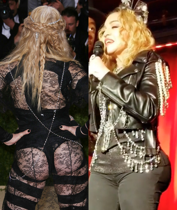 Madonna butt implants