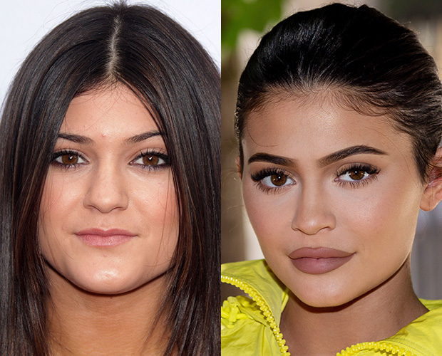 Kylie Jenner slams plastic surgery rumors 