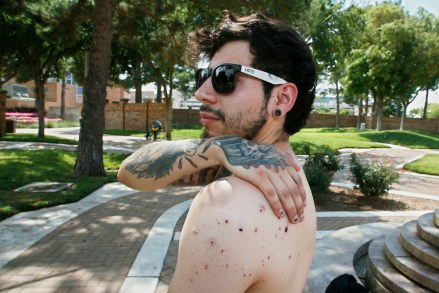 Daniel Munoz reaches for his injured back during an interview, in Odessa, Texas. Munoz was injured in Saturday's shooting. The tattoo on his right hand is a biblical reference, that the wages of sin are death and God's gift is everlasting life
Shooting Texas, Odessa, USA - 01 Sep 2019