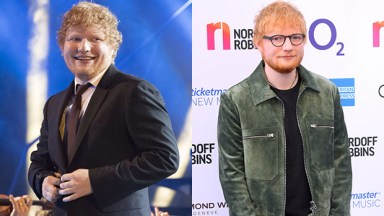 Ed Sheeran’s Weight Loss: Quit Smoking & More — Before & After Photos ...