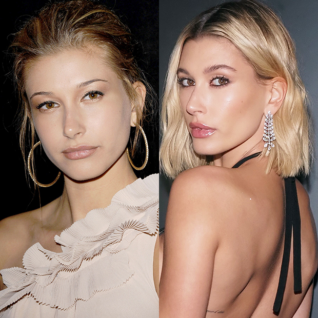 Hailey Baldwin On Plastic Surgery ‘I Did Not Touch My