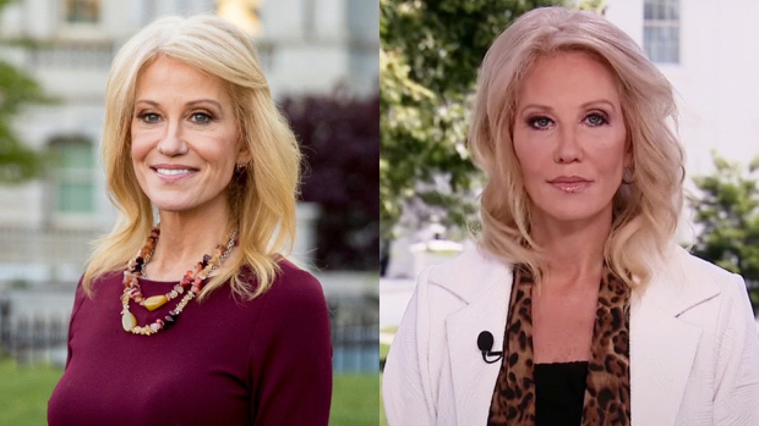 Kellyanne Conways Face Looks Different And Sparks Plastic Surgery Rumor Hollywood Life