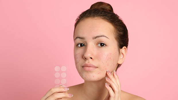 If Your Skin Is Breaking Out, These Pimple Patches With Over 10,400