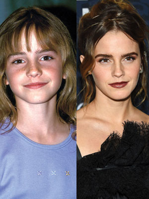 Emma Watson Through The Years: Photos – Hollywood Life