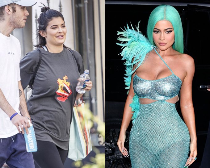 Kylie Jenner’s Post-Baby Body