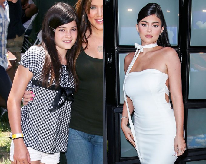 Kylie Jenner: Before & After Superstardom