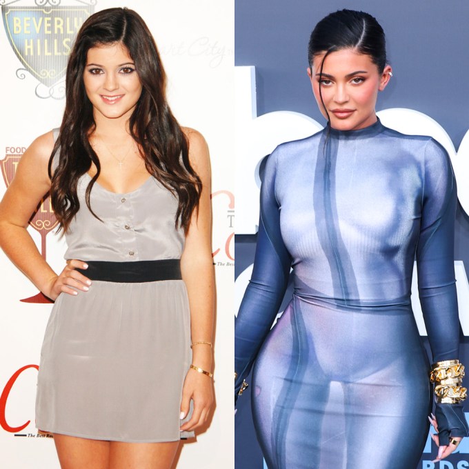 Kylie Jenner: Then & Now