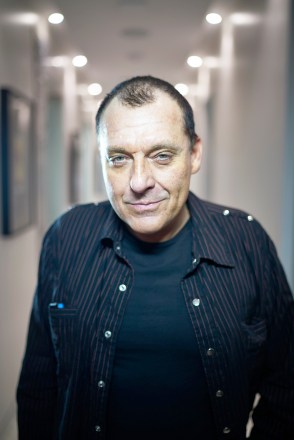 EXCLUSIVE: FILE PICS: Actor Tom Sizemore, pictured before and after his hair transplant surgery at The Beverly Hills Center for Plastic & Laser Surgery. photographs taken 2017. 25 Jan 2019 Pictured: Tom Sizemore. Photo credit: John Chapple / JohnChapple.com / MEGA TheMegaAgency.com +1 888 505 6342 (Mega Agency TagID: MEGA343540_001.jpg) [Photo via Mega Agency]