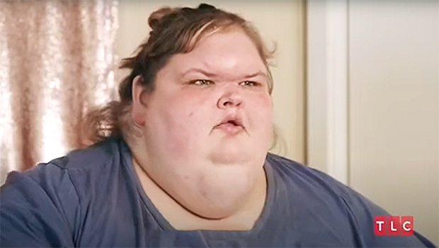 ‘1,000 pounds’ sister actor Tammy Slatan reveals a new face after losing weight.