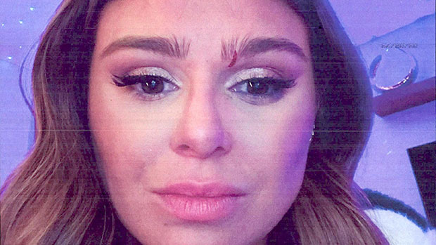 Raquel Leviss Shows Bruised Eye & Cut Face After Scheana Shay Allegedly Attacked Her: Photos