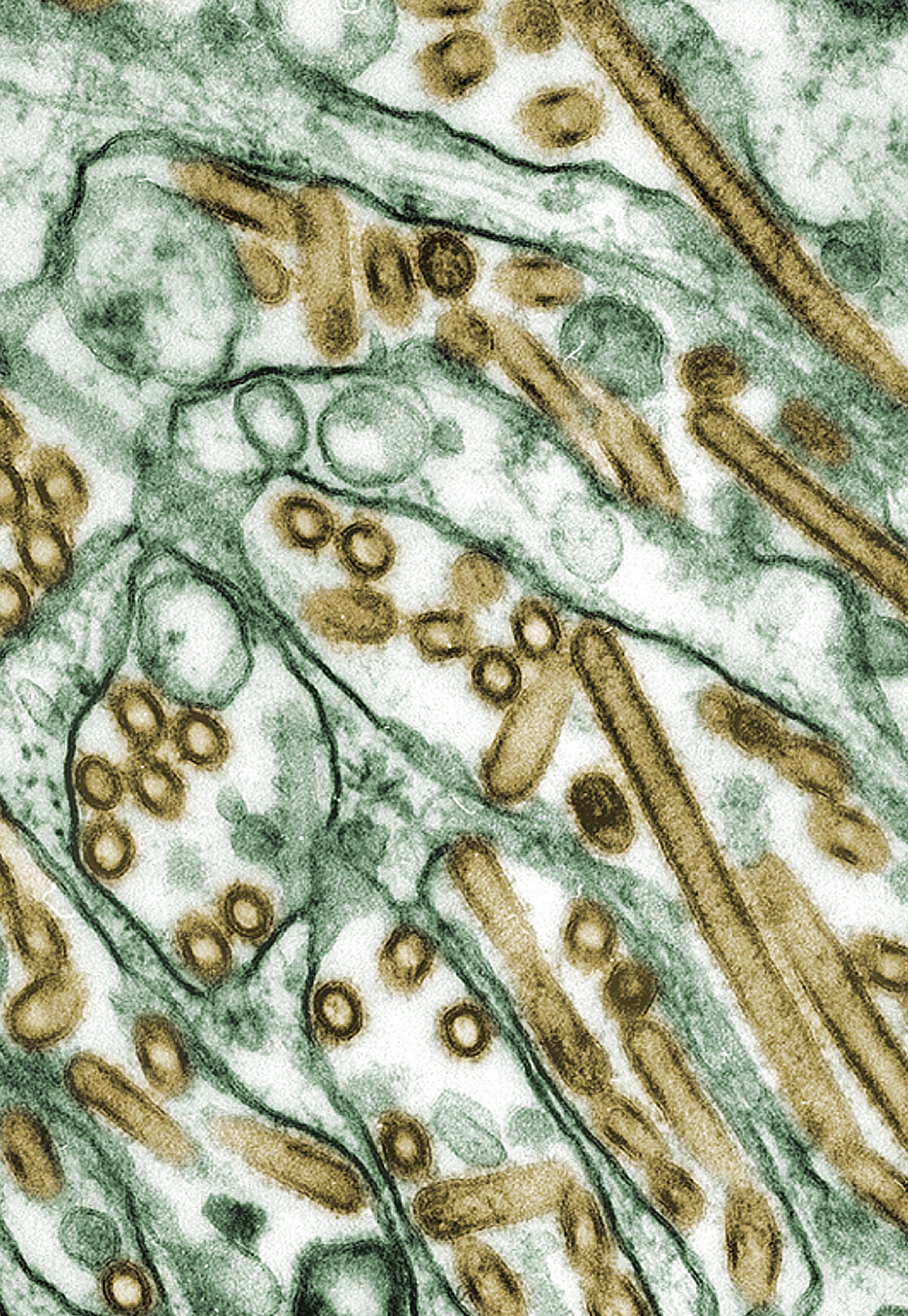 What Is Bird Flu? Symptoms & Cure Amid the H5N1 California Outbreak