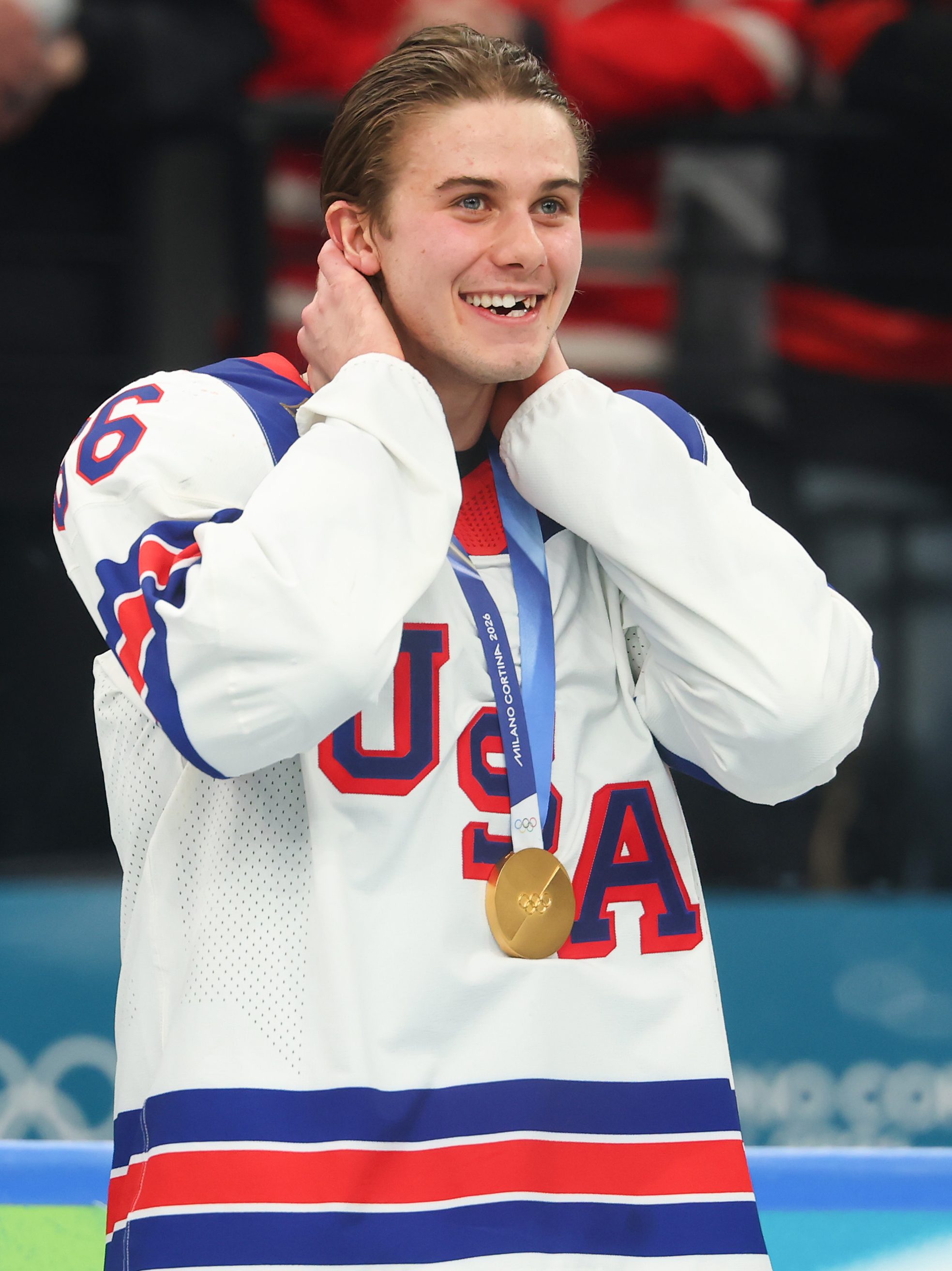 Did Jack Hughes Lose a Tooth in the Olympics? How He Lost His Front Teeth
