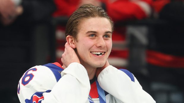 Did Jack Hughes Lose a Tooth in the Olympics? How He Lost His Front Teeth