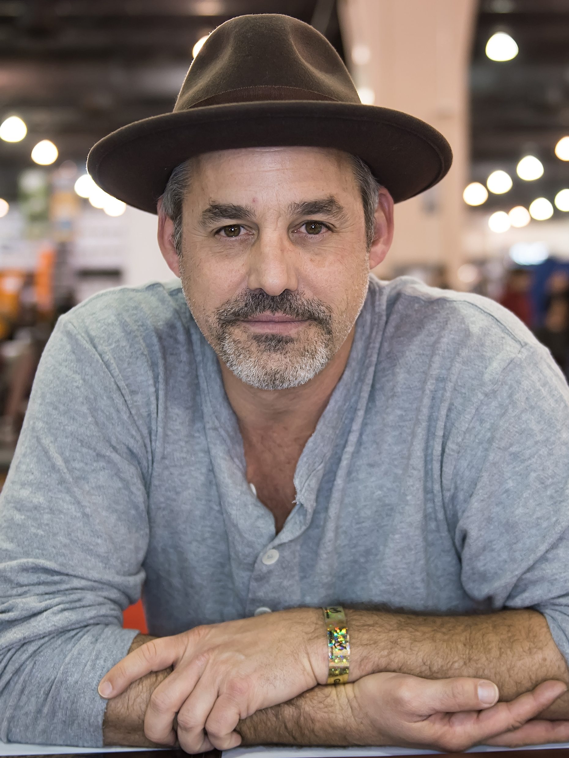 Nicholas Brendon's Health: His Cauda Equina Syndrome, Heart Defect & Other Issues Explained