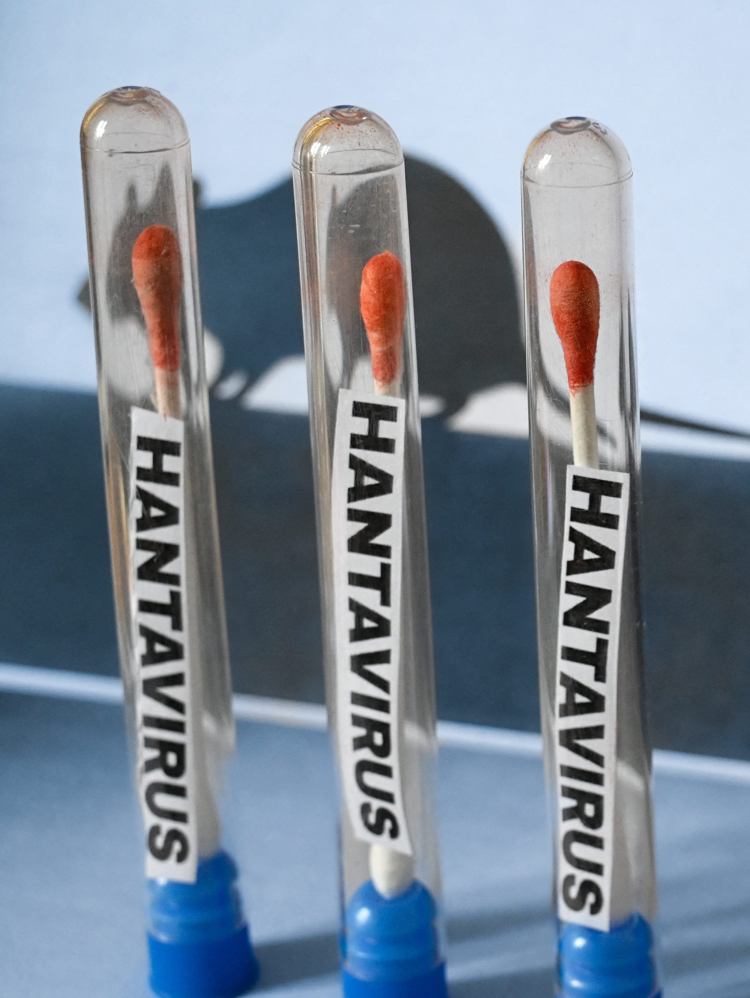 Is Hantavirus Contagious? Outbreak Updates, Treatment Information & Mortality Rate